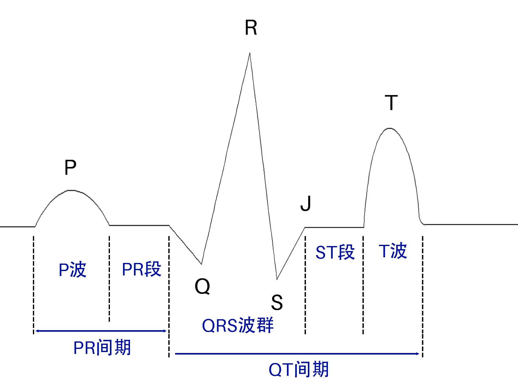 心电图各波段的组成及命名
